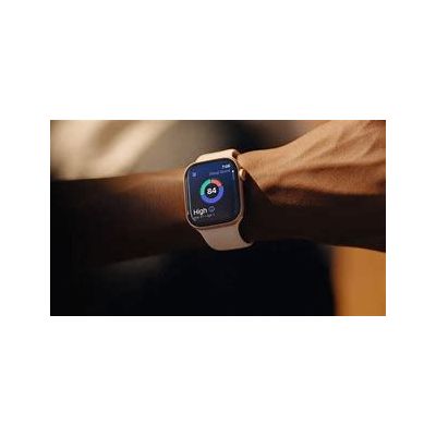apple watch series 11 42mm gold ti l blush sb m/l cel